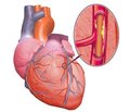 Factors associated with target organ damage regression on the background of perindopril/amlodipin fixed dose combination therapy in hypertensive patients depending on the presence of ischemic heart disease
