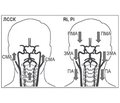 Neurometabolic Correction of Cardiocerebral Disorders in Vascular Encephalopathy