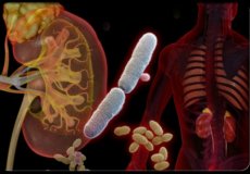 Почечные инфекции: симптомы и лечение