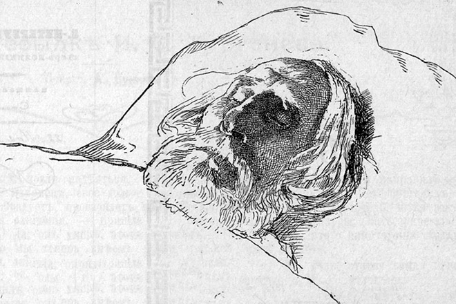 Иван Тургенев на смертном одре