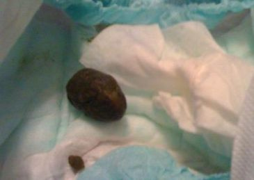 стул ребенка.....( с фото)